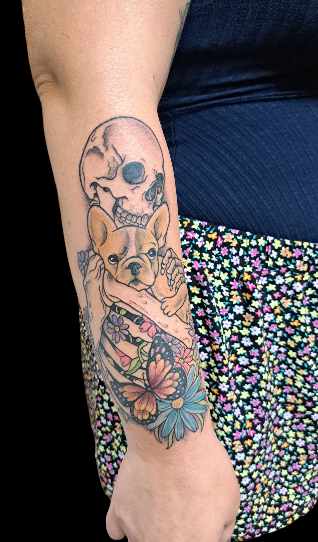 Antebrazo